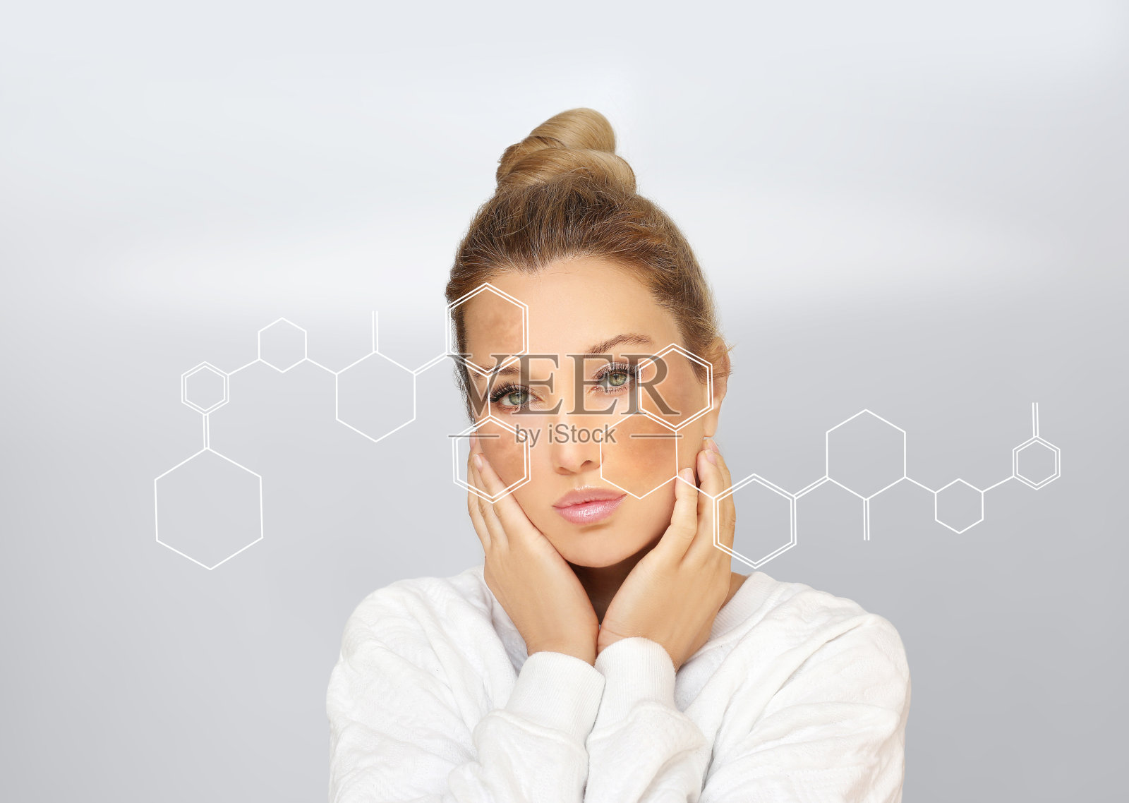 黑斑，雀斑，色素沉着(黄褐斑或黄褐斑)，概念-皮肤提亮，皮肤美白，果酸，AHA，皮肤提亮照片摄影图片