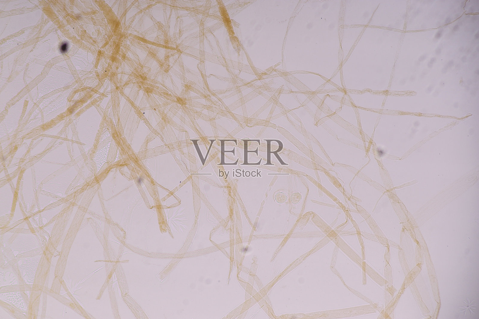 带有孢子(霉菌)的宿主细胞在木材内部。照片摄影图片