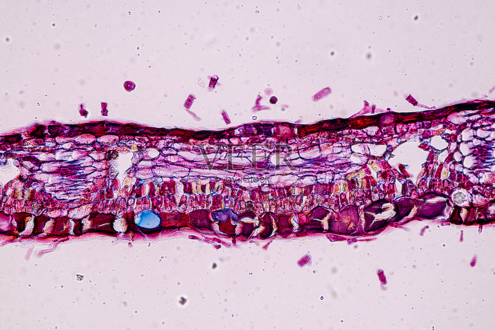 带有孢子(霉菌)的宿主细胞在木材内部。照片摄影图片
