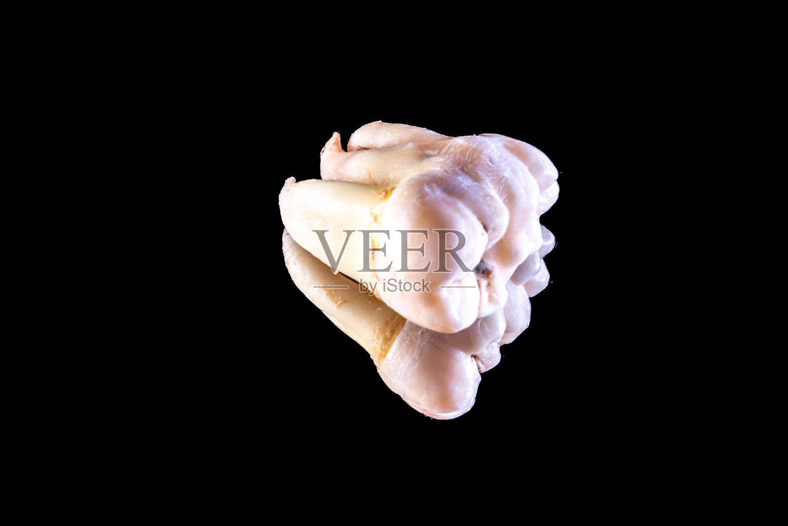 长出48颗下智齿照片摄影图片