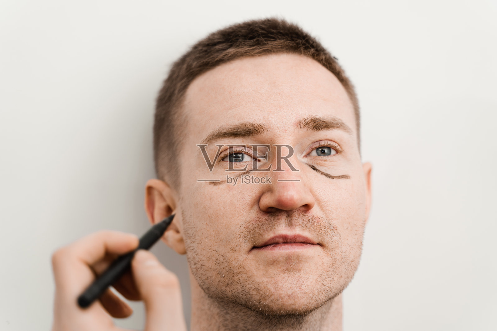 男性上睑成形术及下睑提拉及去疝在医学诊所眼部整形手术前的面部标记。照片摄影图片