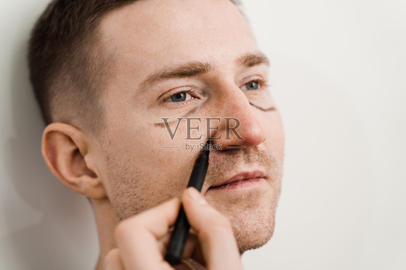 男性上睑成形术及下睑提拉及去疝在医学诊所眼部整形手术前的面部标记。照片摄影图片