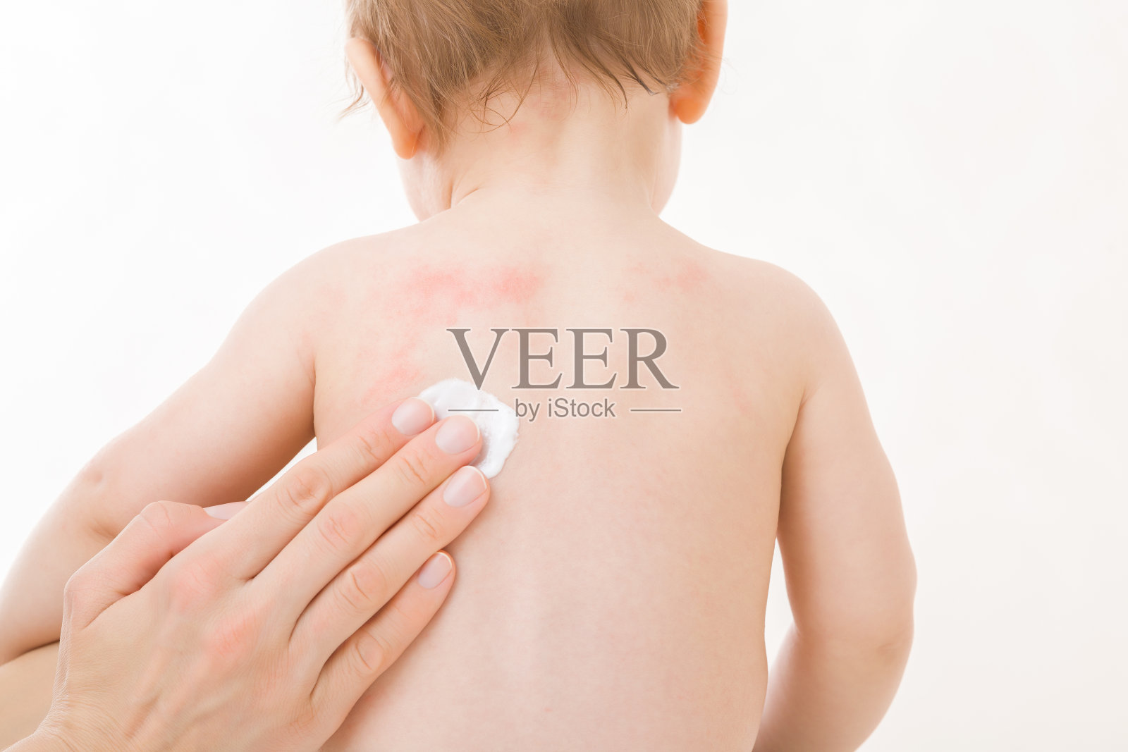 母亲的手指将白色药膏涂抹在婴儿裸露的背部，隔离在浅灰色的背景上。皮肤上有红疹。对食物、配方奶或母乳过敏。关心宝宝的身体。特写镜头。照片摄影图片