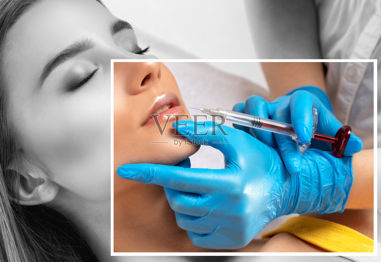 美容师给美女注射丰唇和鼻唇褶皱抗皱。美容院的女性美容。照片摄影图片