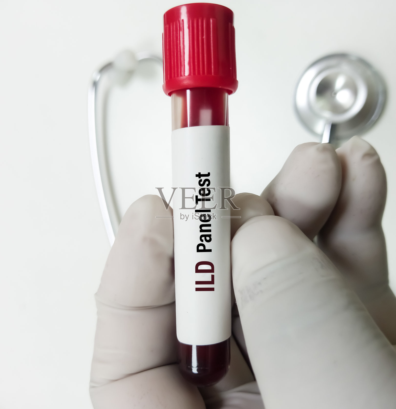 肺间质性疾病(ILD)自身抗体检测血液样本。照片摄影图片