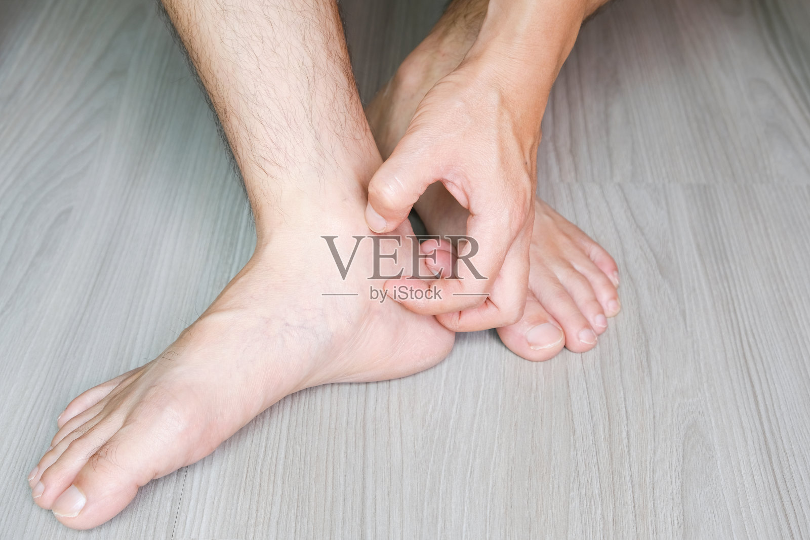 男人穿帆布鞋，他抓腿和脚痒的皮肤。由鞋子引起照片摄影图片