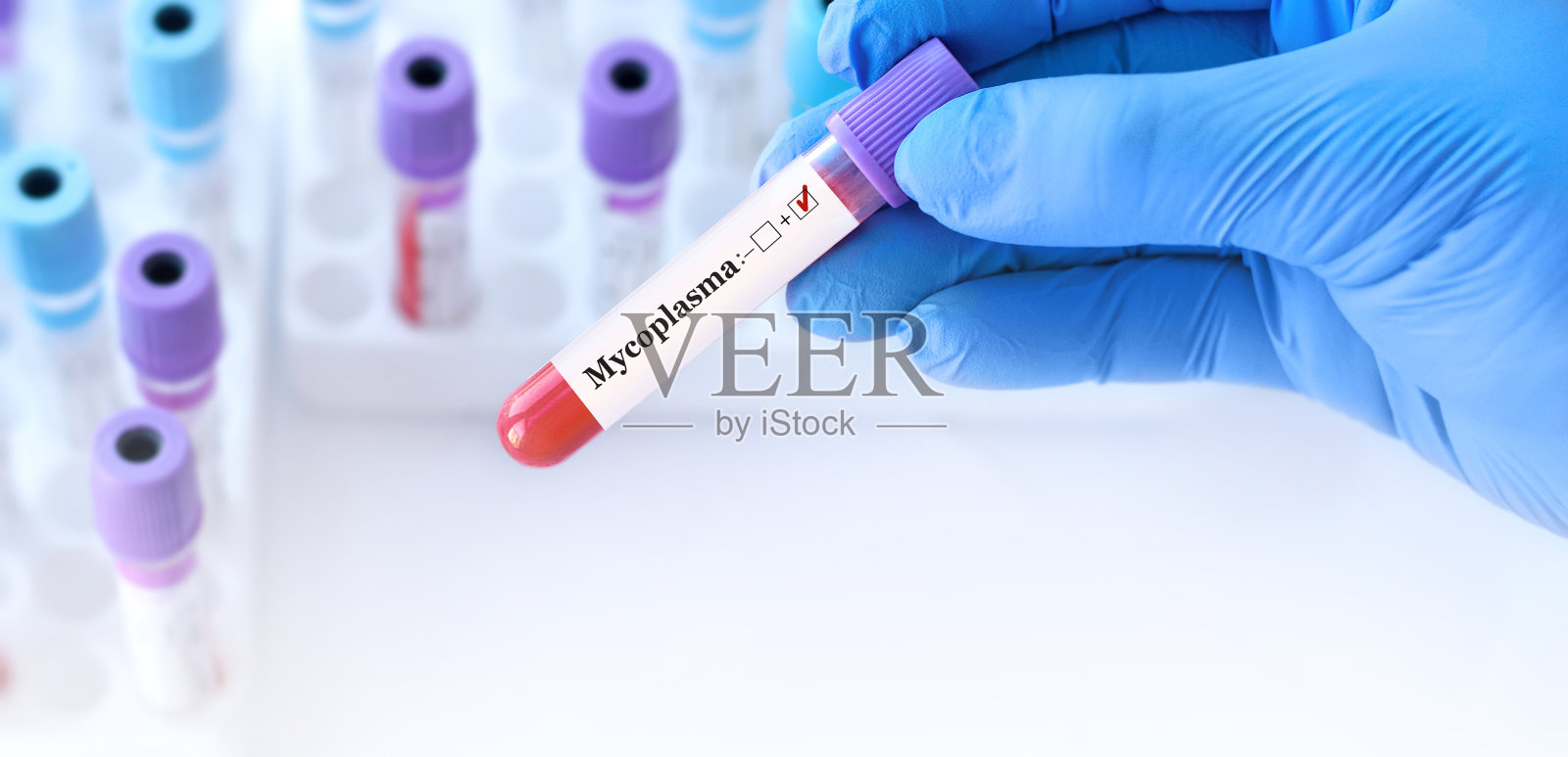 医生拿着检测支原体检测阳性的血样管，背景是医用试管与分析。横幅。照片摄影图片