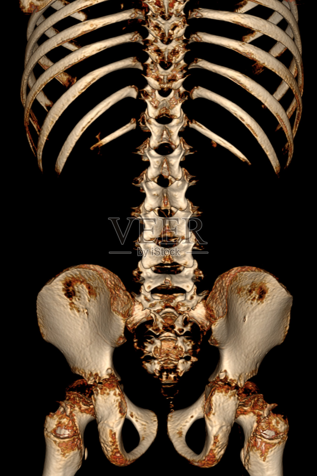 骷髅骨照片摄影图片