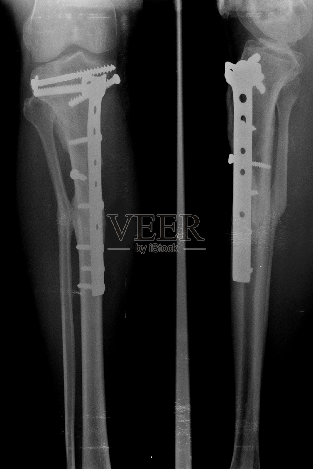 常规放射照片照片摄影图片
