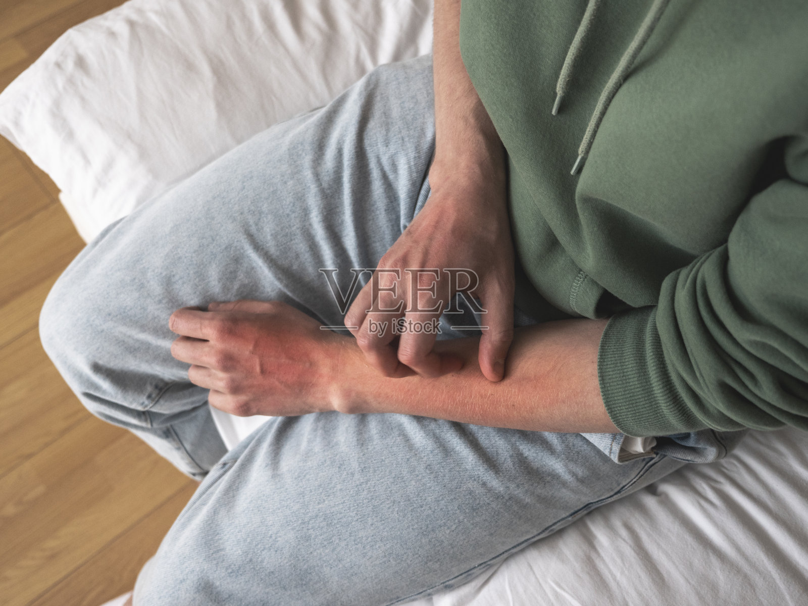 男子抓伤手，破损皮肤发红。刮伤神经症，皮肤抓伤，情绪紧张或过敏照片摄影图片