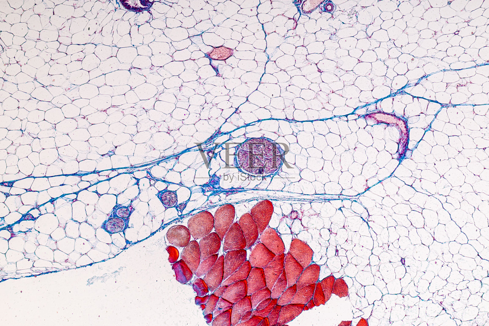 实验室显微镜下人体静脉、动脉、主动脉组织。照片摄影图片