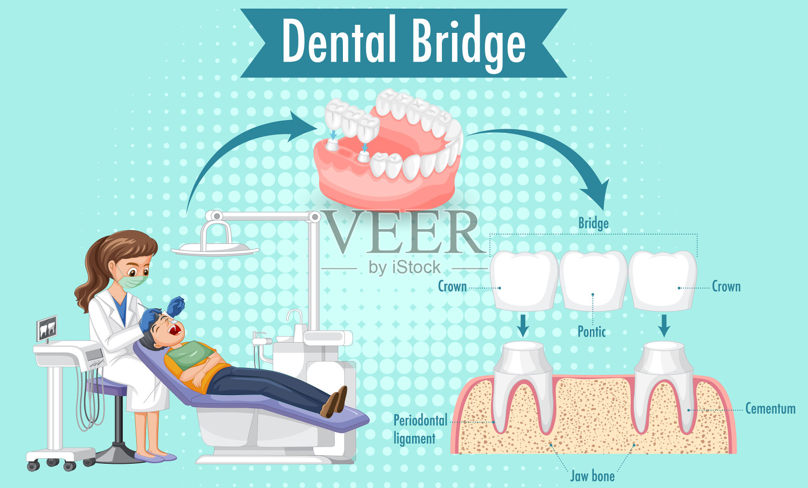 人牙桥的资讯图设计模板素材