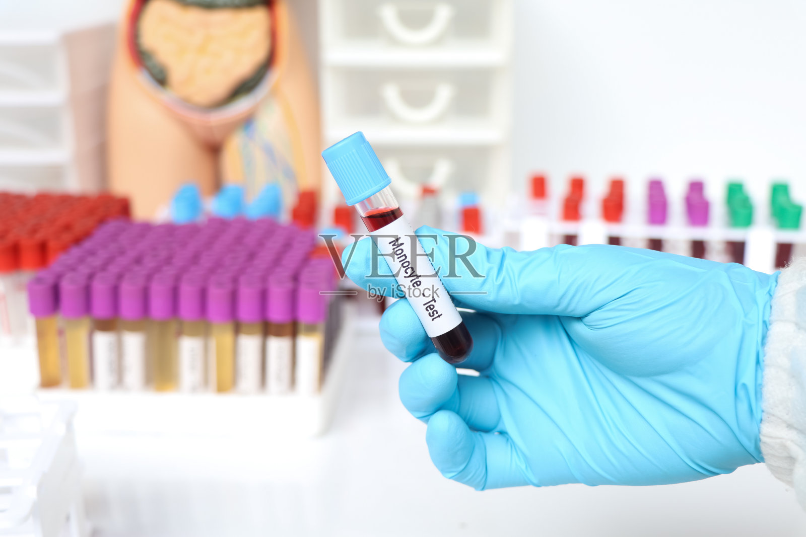 单核细胞测试，血液样本在实验室分析照片摄影图片