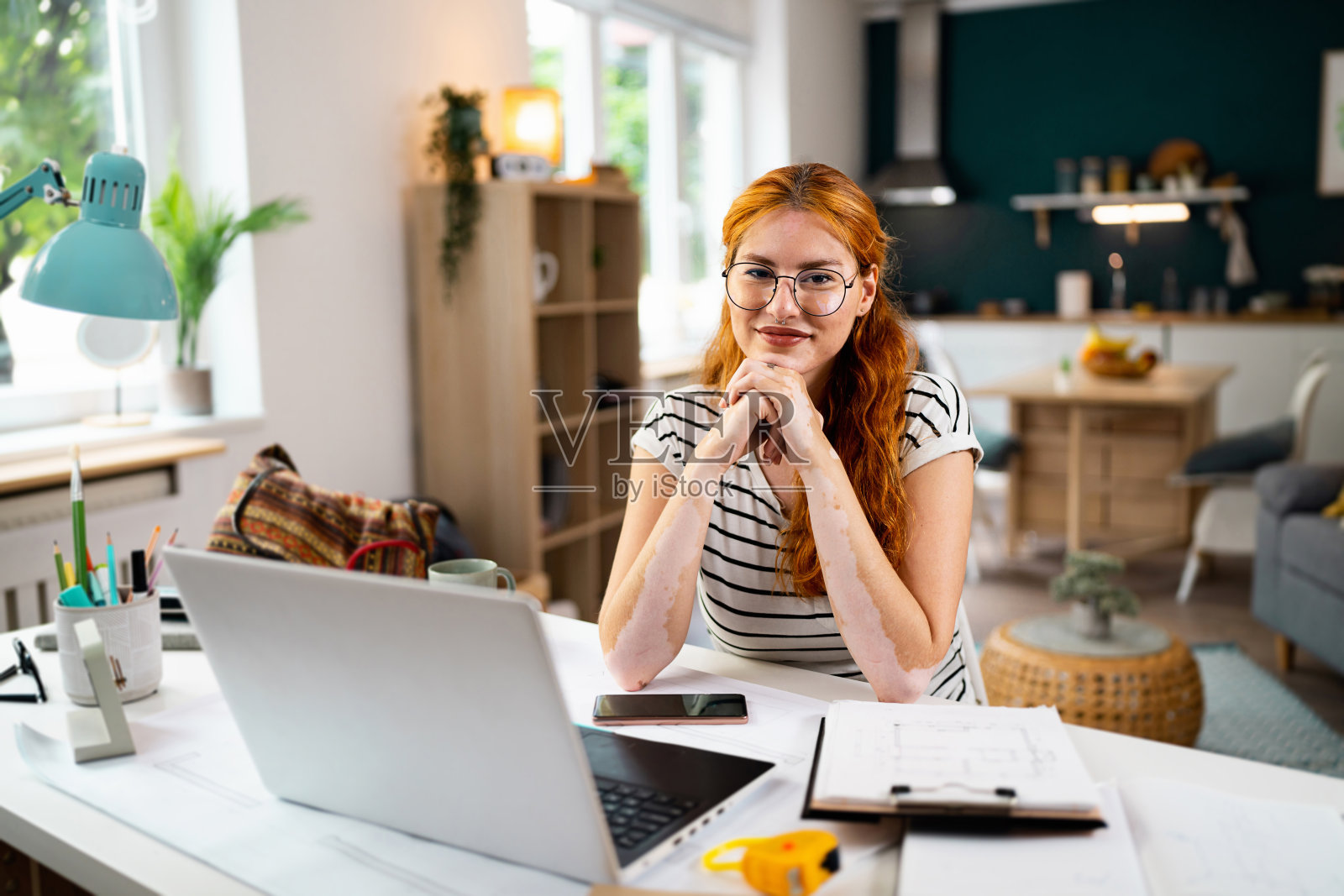 患有白癜风的红发年轻女性的肖像，在家工作照片摄影图片