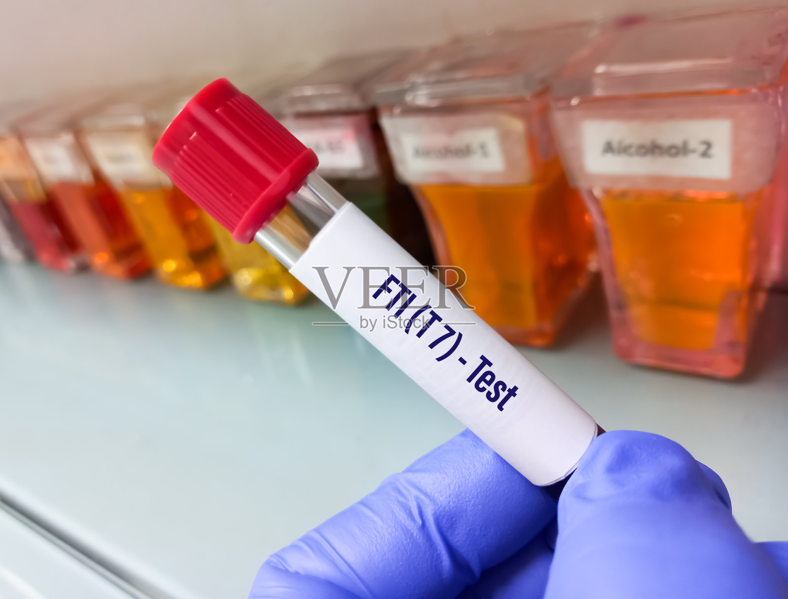 用于FTI(T7)检测的血样管。游离甲状腺素指数试验。照片摄影图片