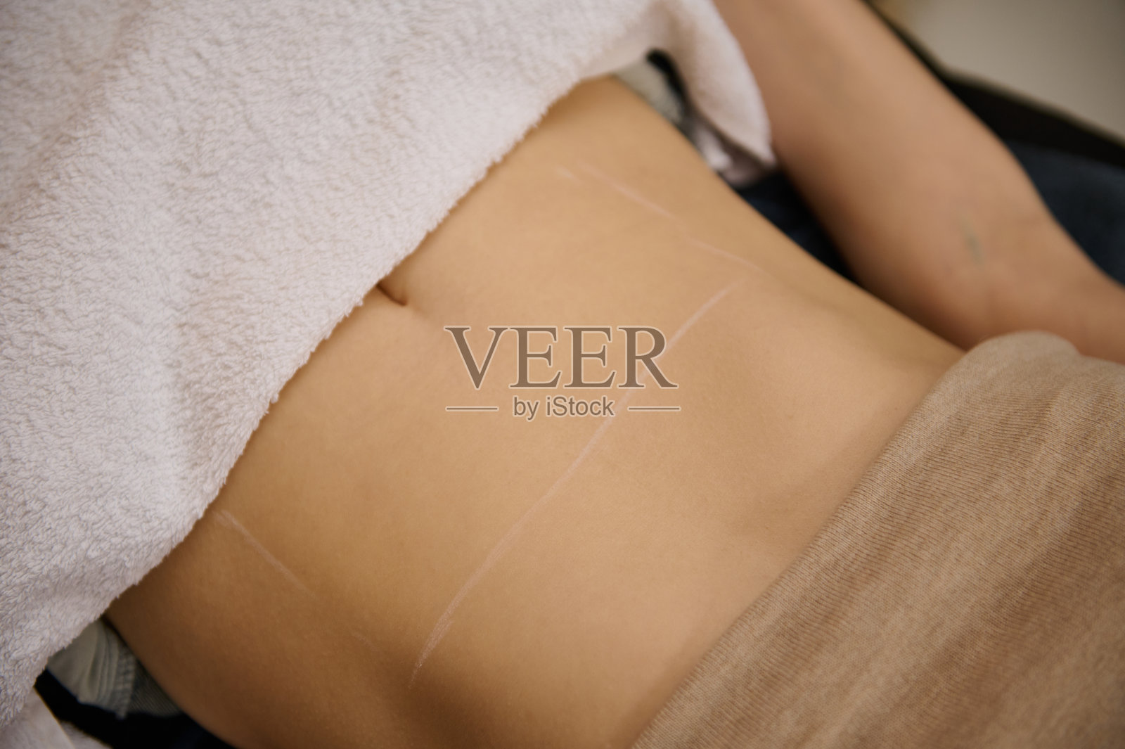 利用现代医疗设备在水疗中心进行减脂、减脂治疗前，画出平坦的腹部线条照片摄影图片