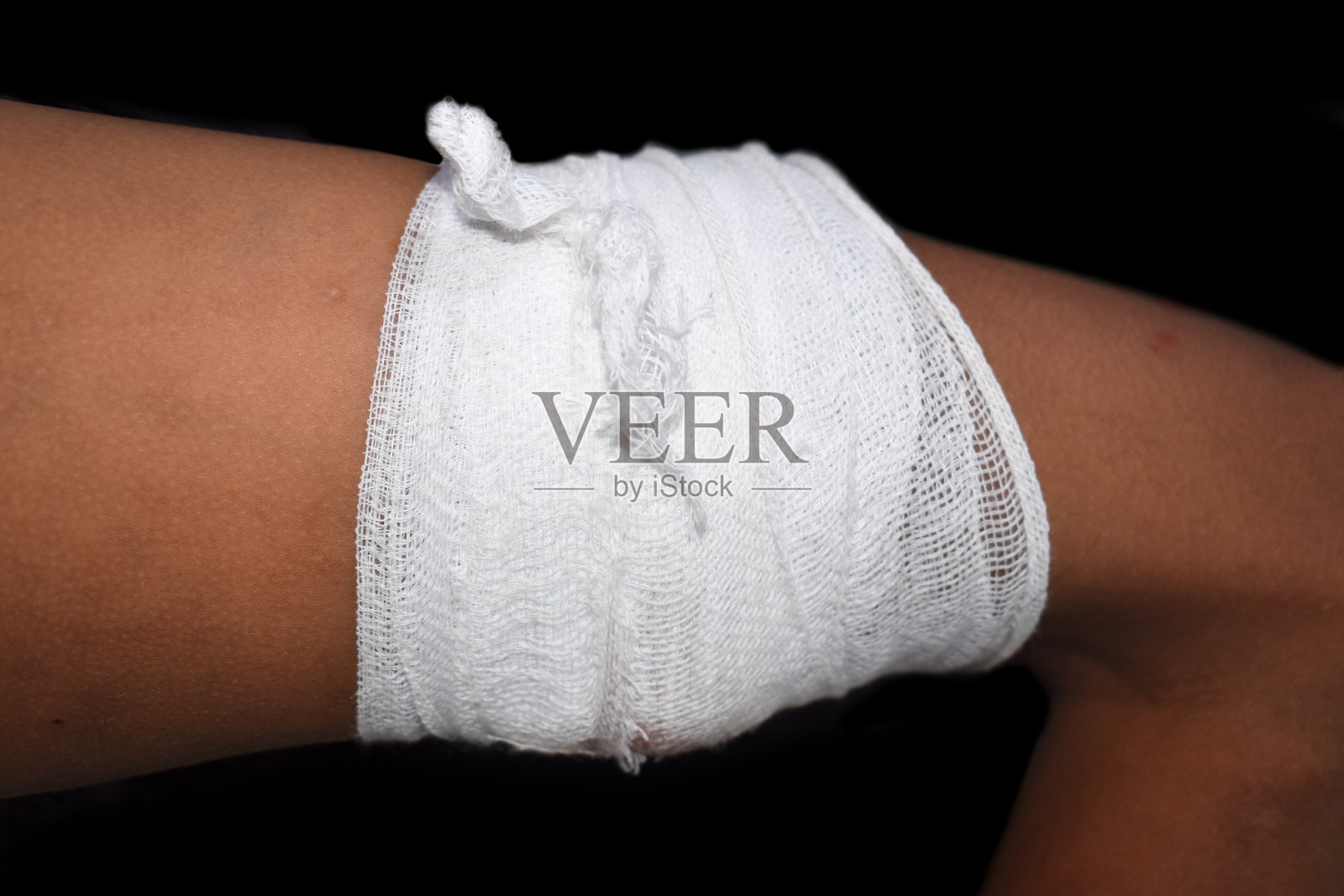 大腿外伤医用敷料。照片摄影图片