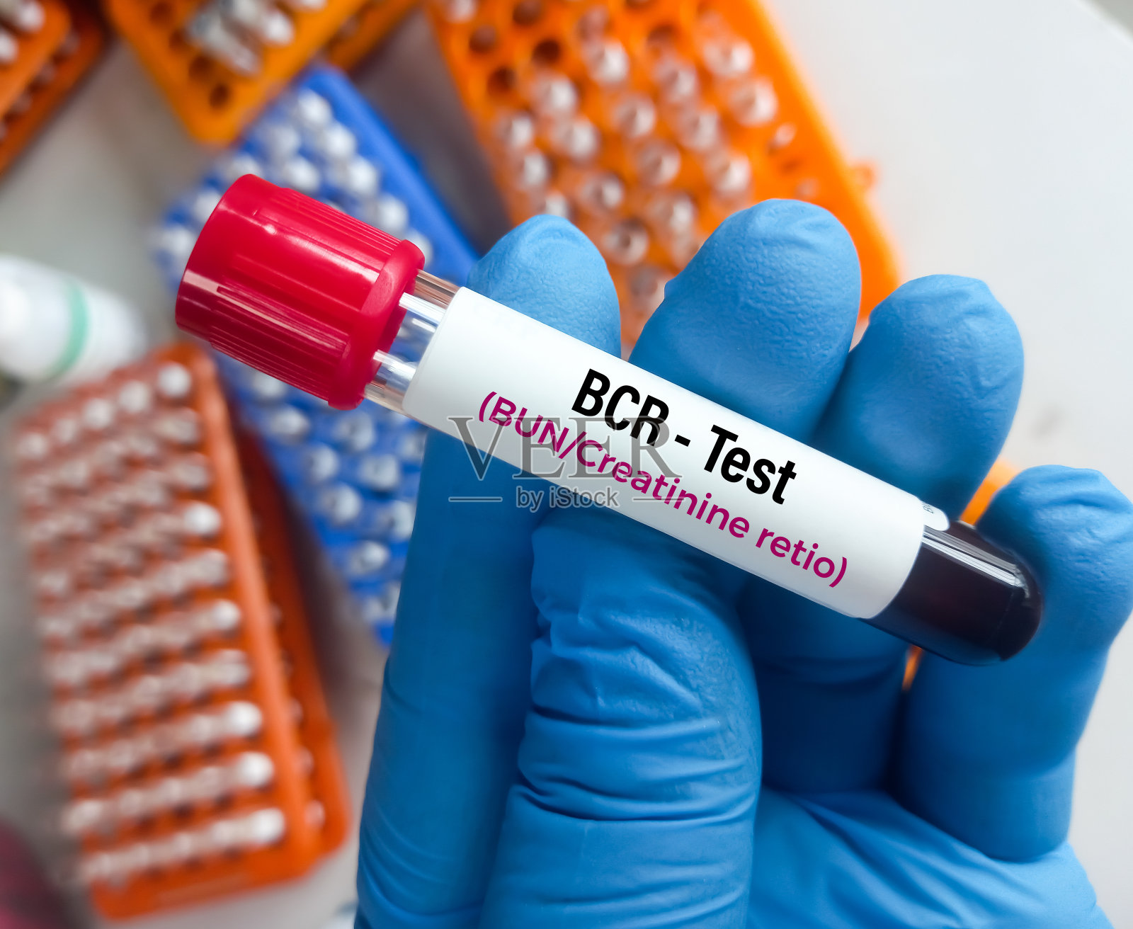血尿素氮和肌酐比率(BCR)测试表明有潜在的疾病。充血性心力衰竭或脱水。照片摄影图片