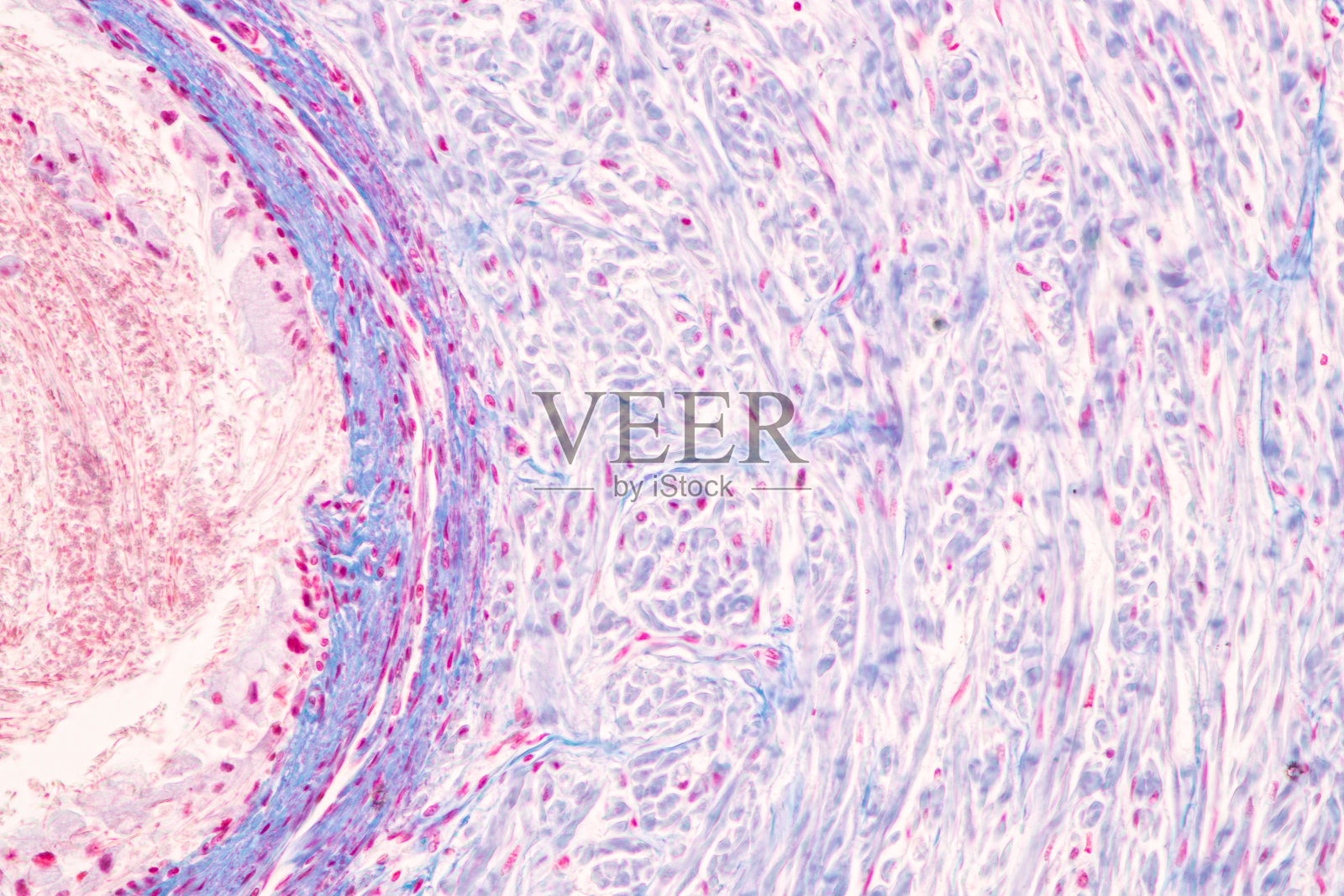 显微镜下的组织学:人精索、人精囊、人前列腺、人染色体。照片摄影图片
