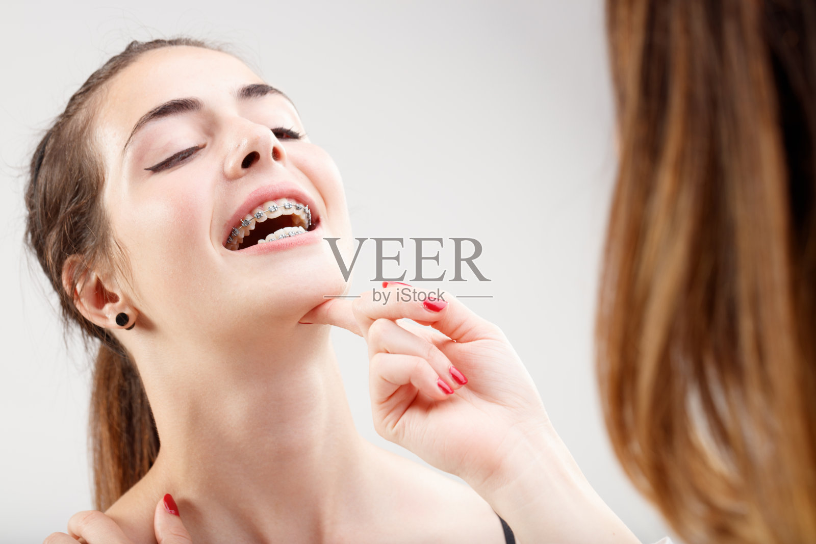 牙医检查牙套;特写，微笑的女孩，很专业照片摄影图片