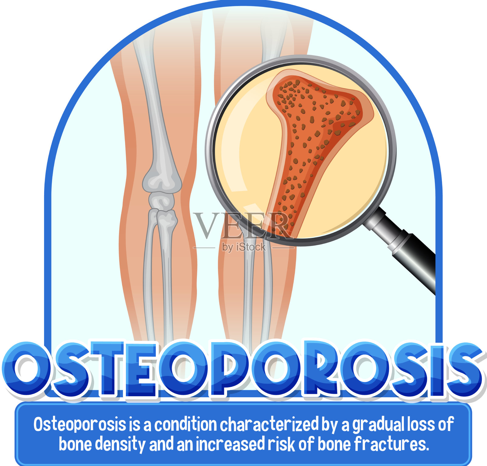 骨质疏松症的宣传海报插画图片素材