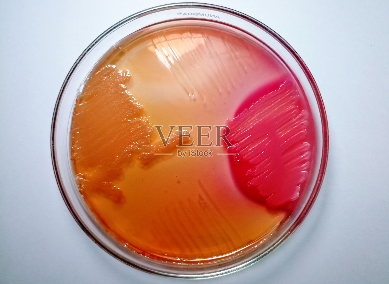 大肠杆菌的生长。麦康基琼脂培养基尿液培养。照片摄影图片