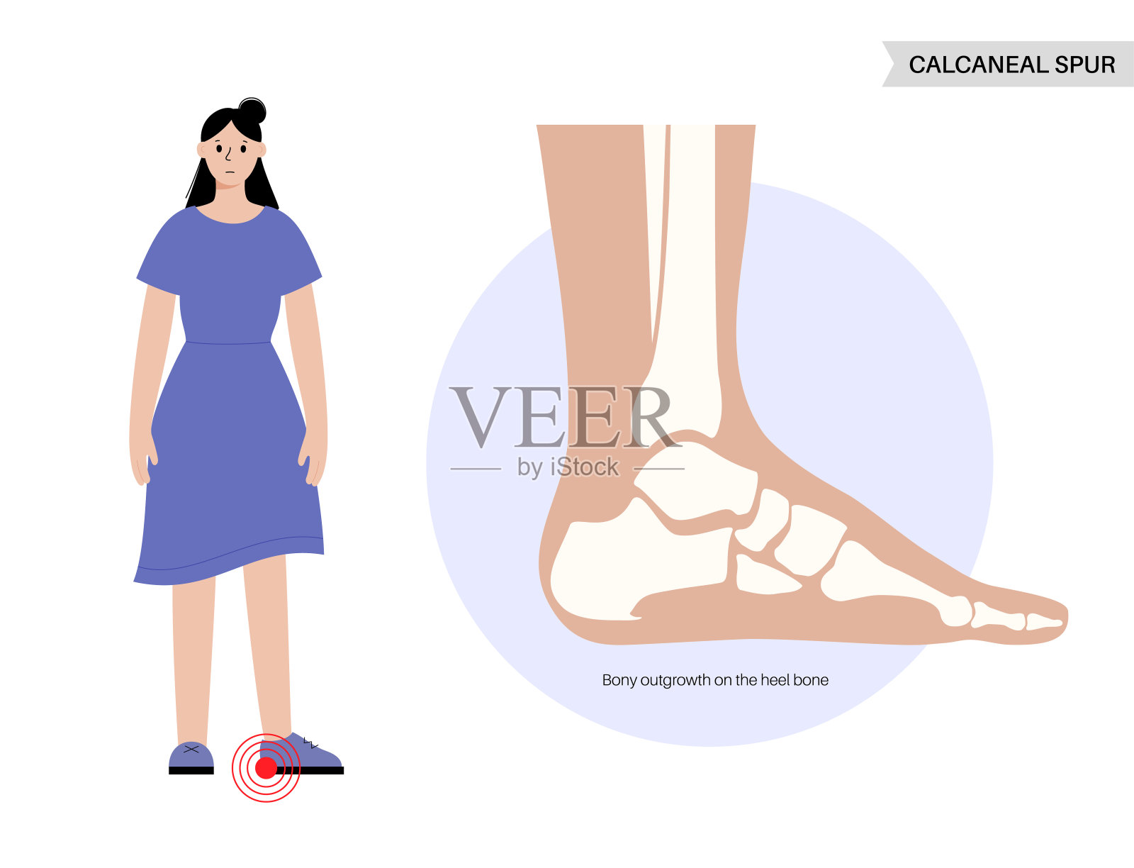 鞋跟直纹海报插画图片素材