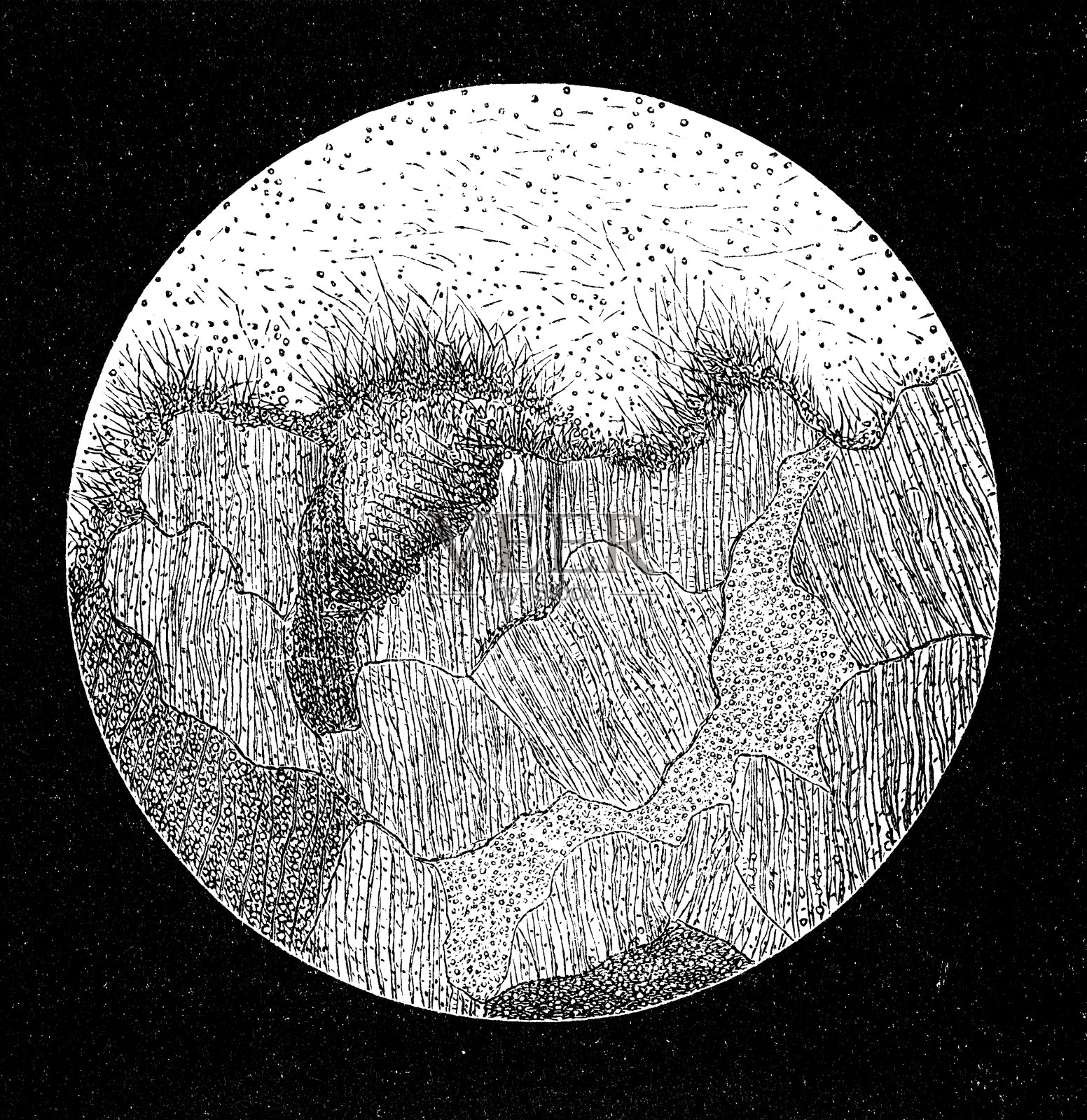 在显微镜下被真菌破坏的牙齿插画图片素材