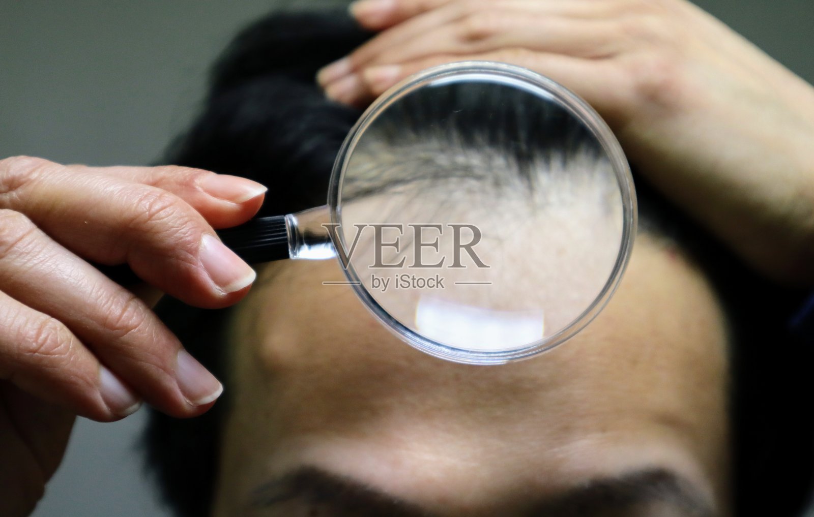 日本男性正遭受头发稀疏的困扰照片摄影图片