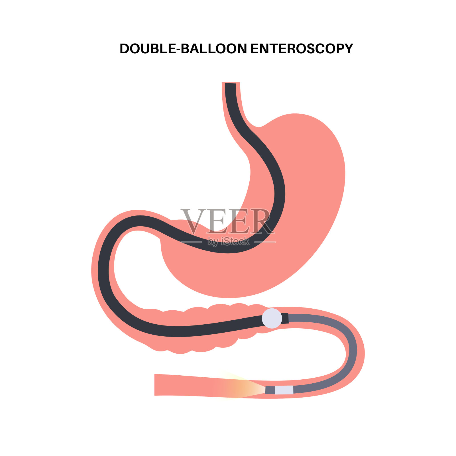双气囊小肠镜检查插画图片素材
