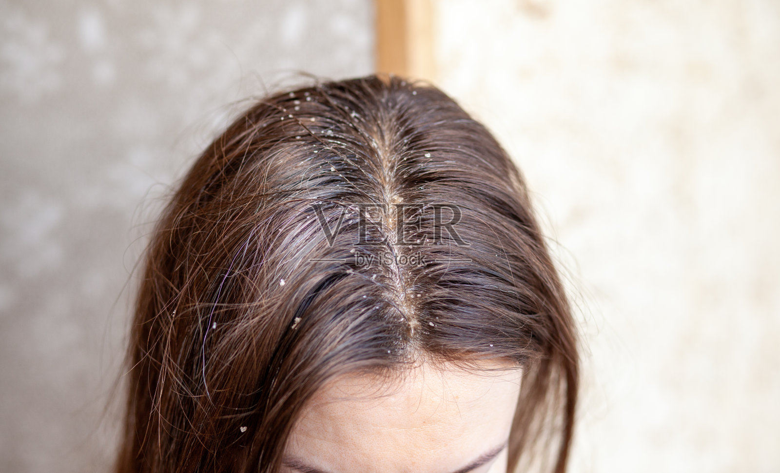 分头发:女性头上的头发分头发护发和护理。照片摄影图片