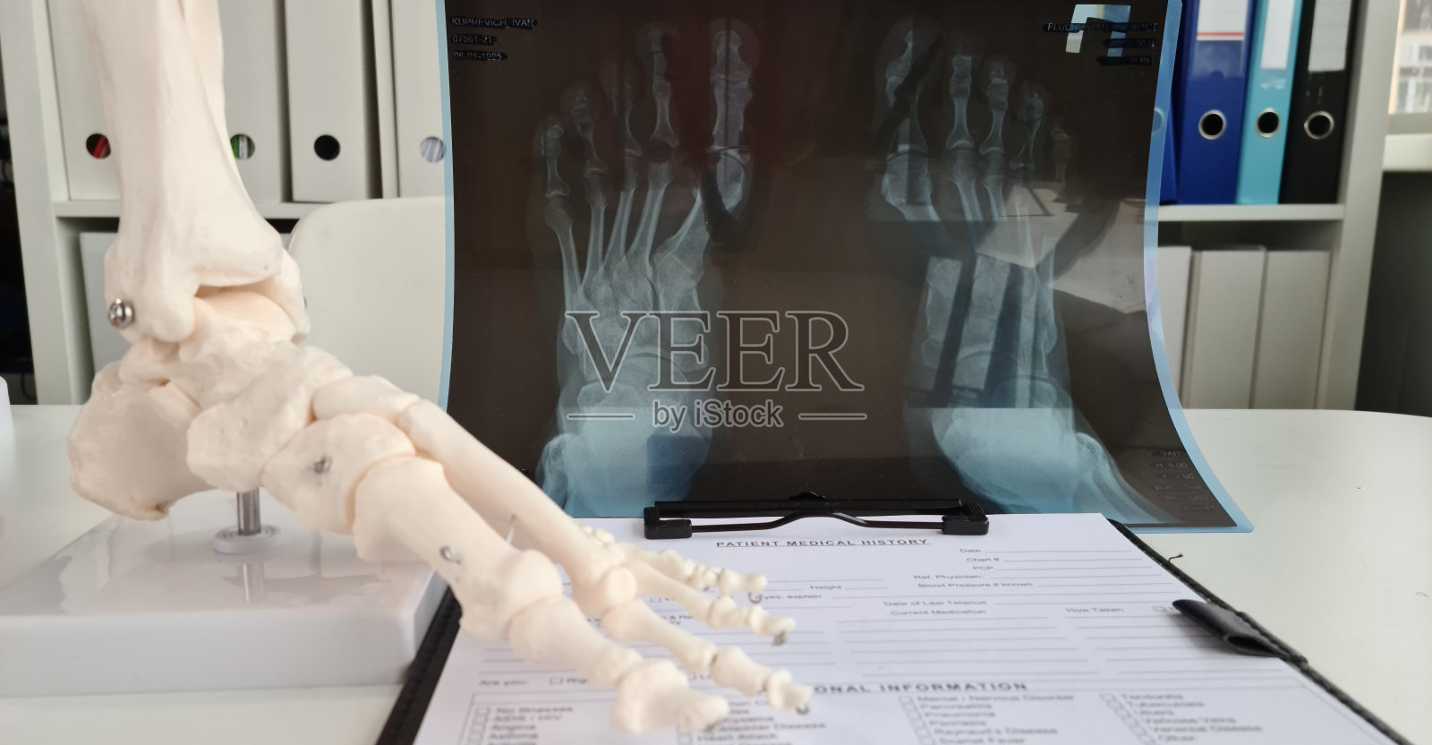 外科创伤学家评估足部x光片特写照片摄影图片