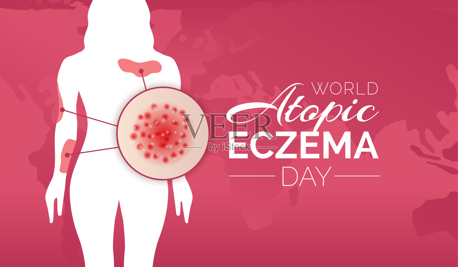 红色世界特应性湿疹日背景插图设计与一个女孩插画图片素材