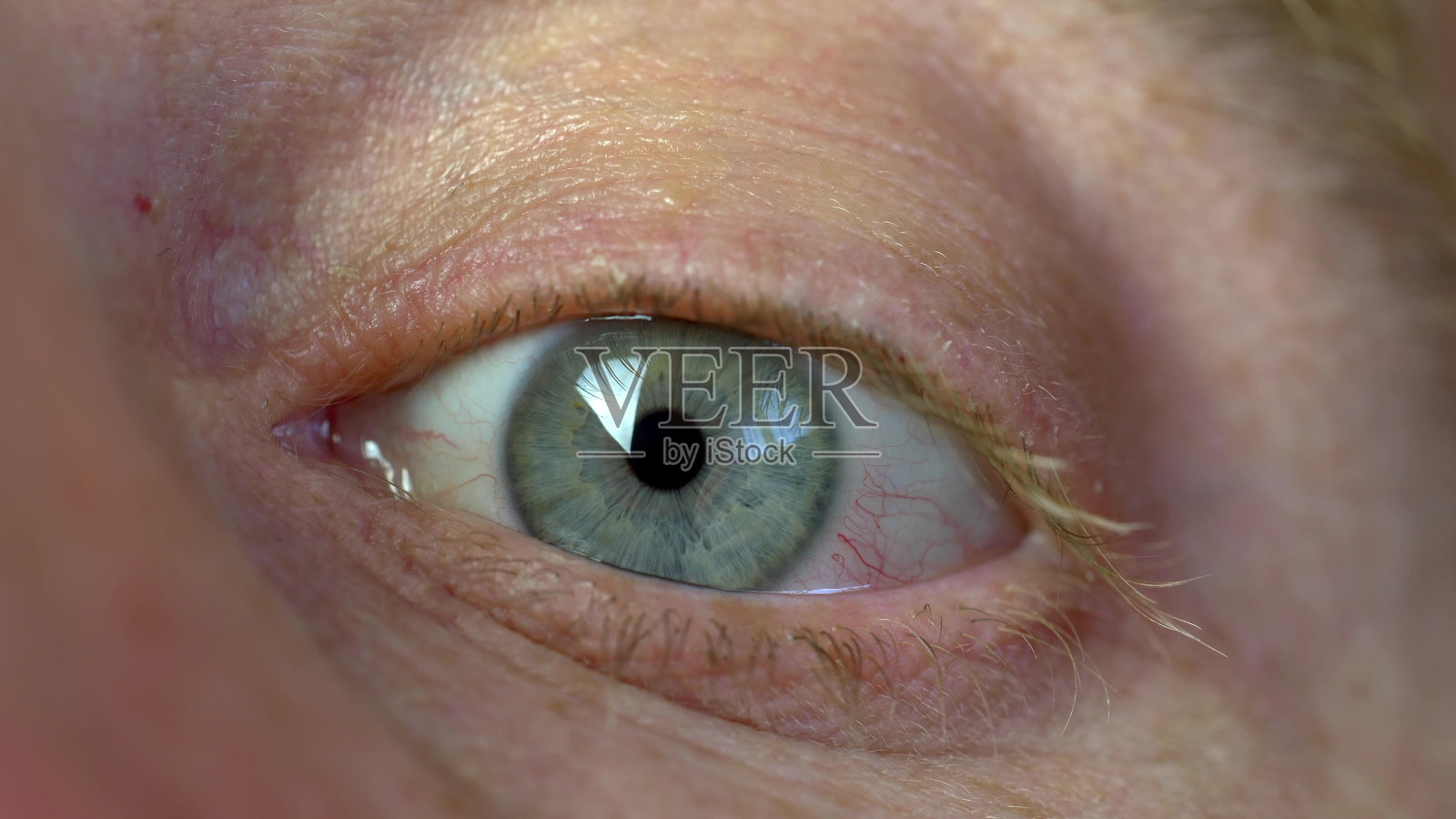 将眼药水滴入因眼炎而充血的眼睛照片摄影图片