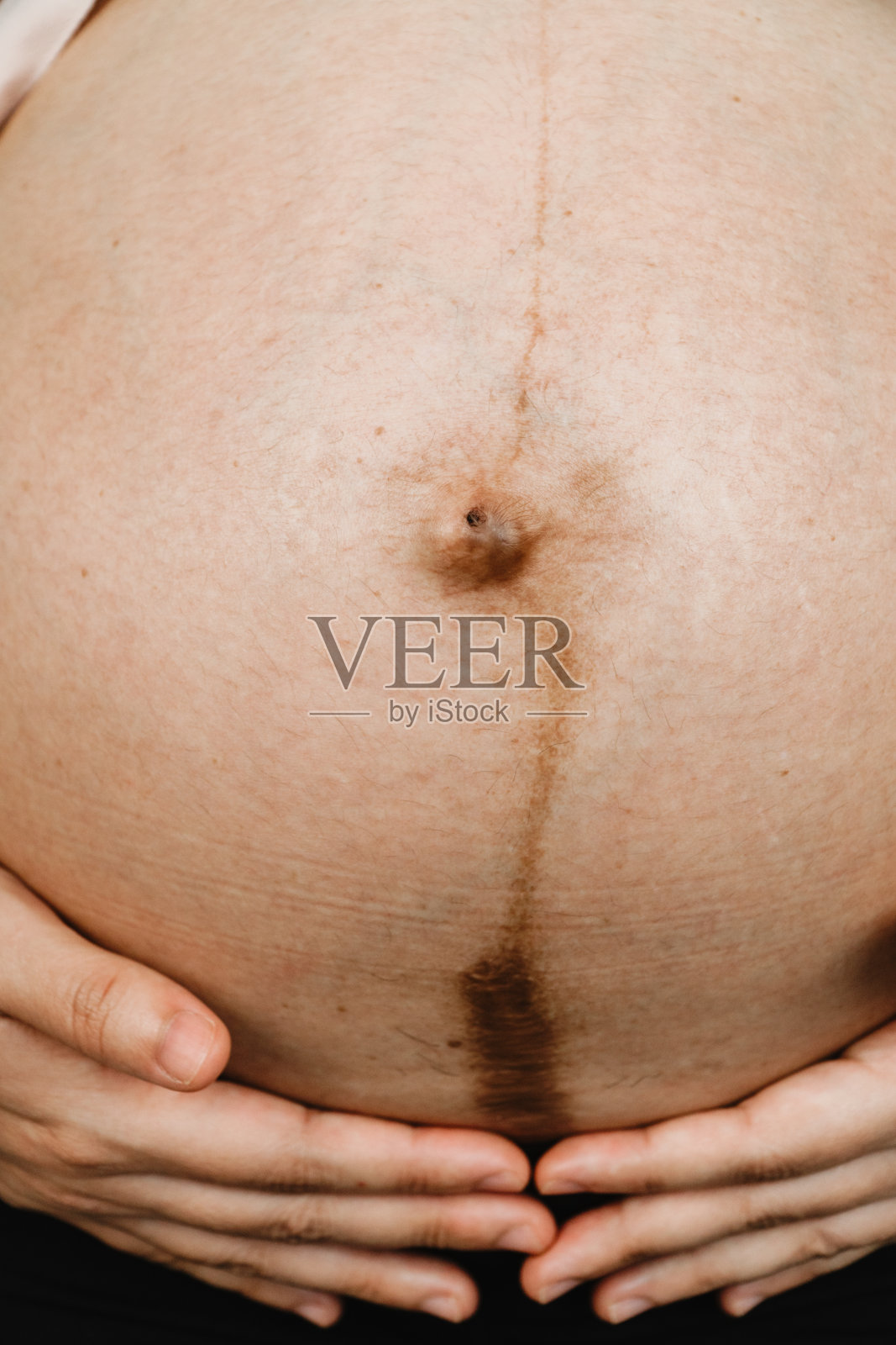 特写镜头，剖宫产留下疤痕的女人腹部。照片摄影图片