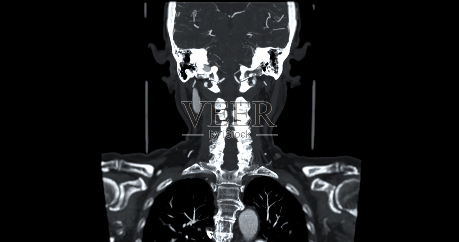 脑部CT血管造影。医疗技术理念。照片摄影图片