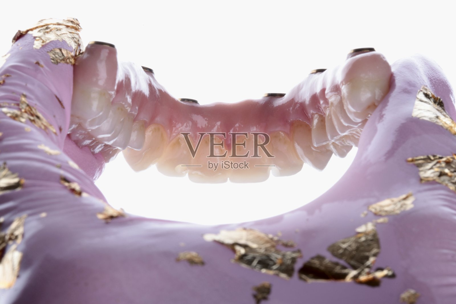 人工牙龈修复:氧化锆弓与螺钉种植体照片摄影图片