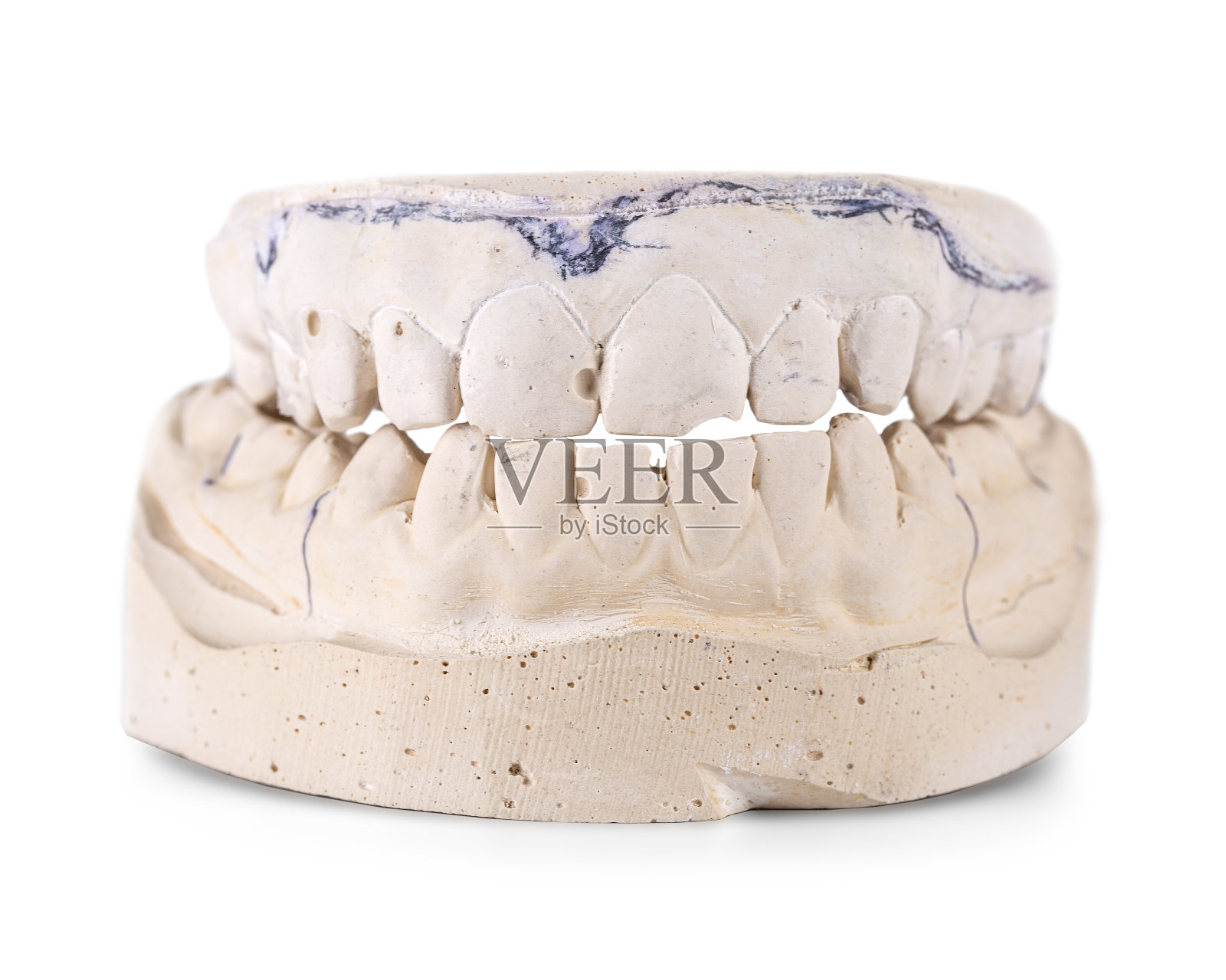 铸造的下颚的牙齿由石膏隔离在白色上照片摄影图片