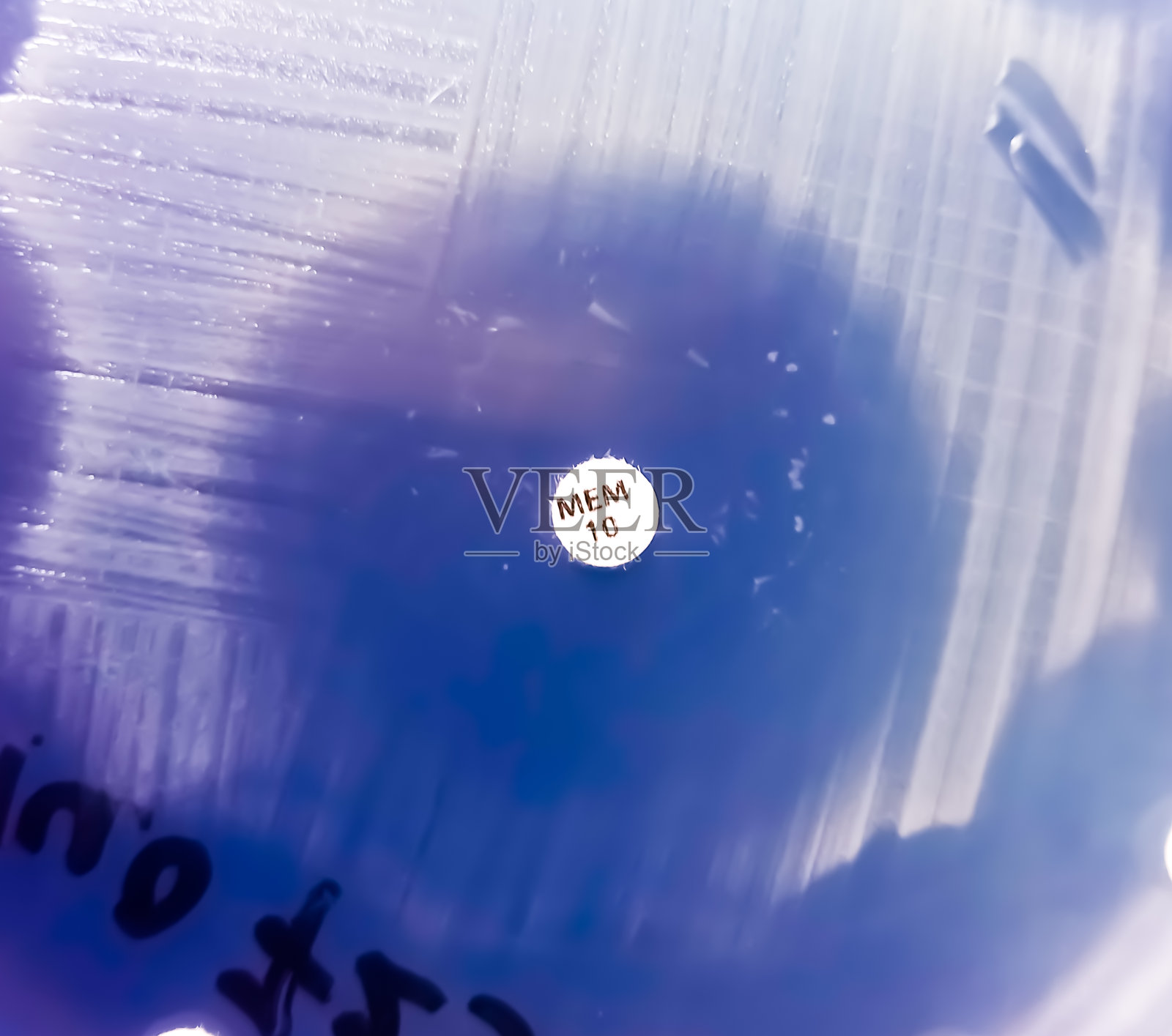 药敏试验显示对美罗培南抗生素敏感。照片摄影图片