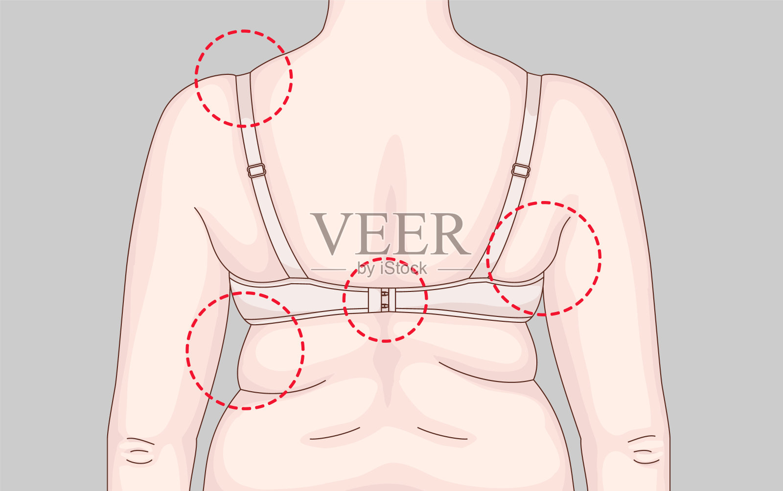 超重。背面有褶皱。错误的胸罩。识别背面的问题区域。插画图片素材