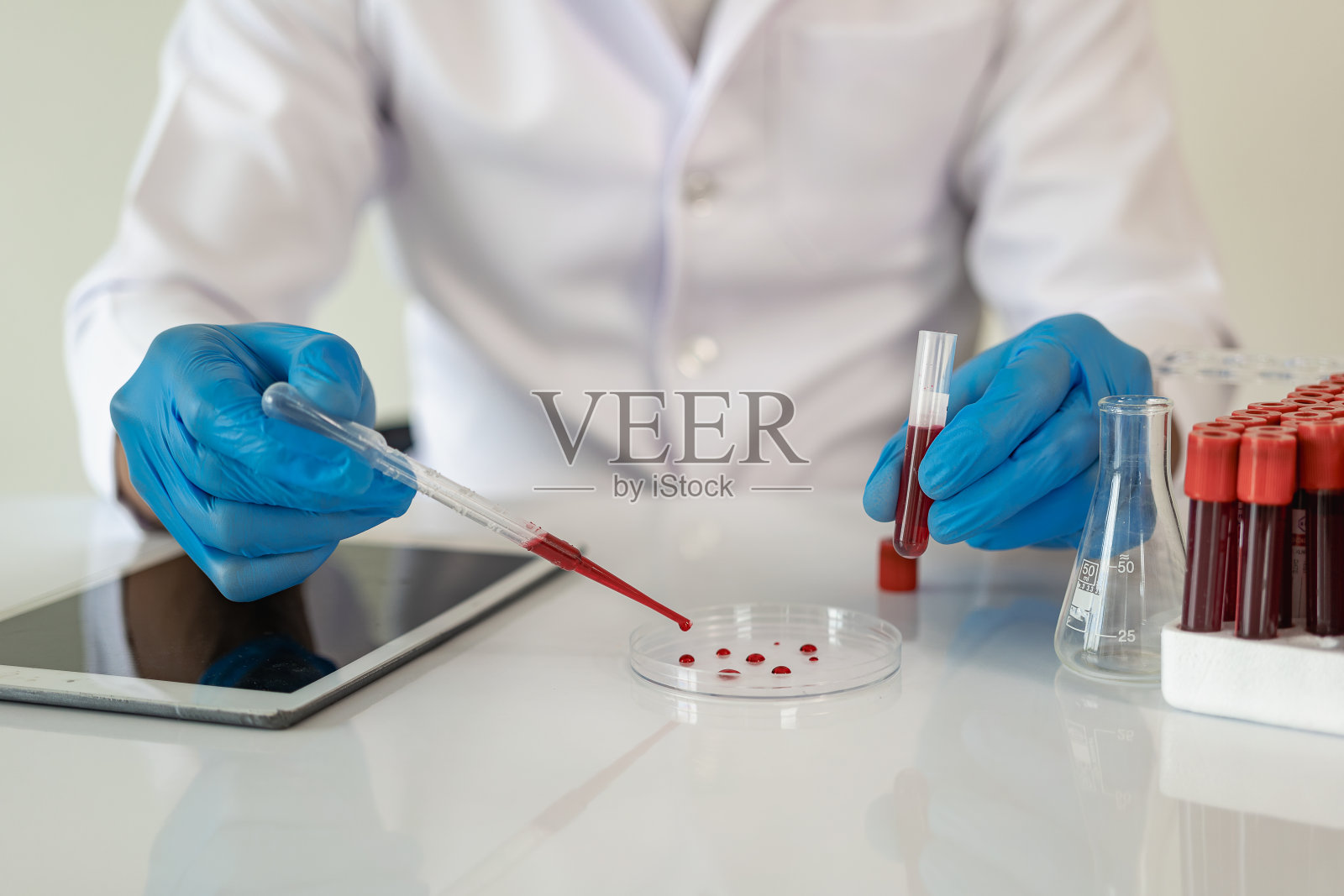 亚洲血液学家检查医学上必要的血液检查根据医疗保险指南由医生订购，尝试诊断血液检查，实验室服务特写图片照片摄影图片