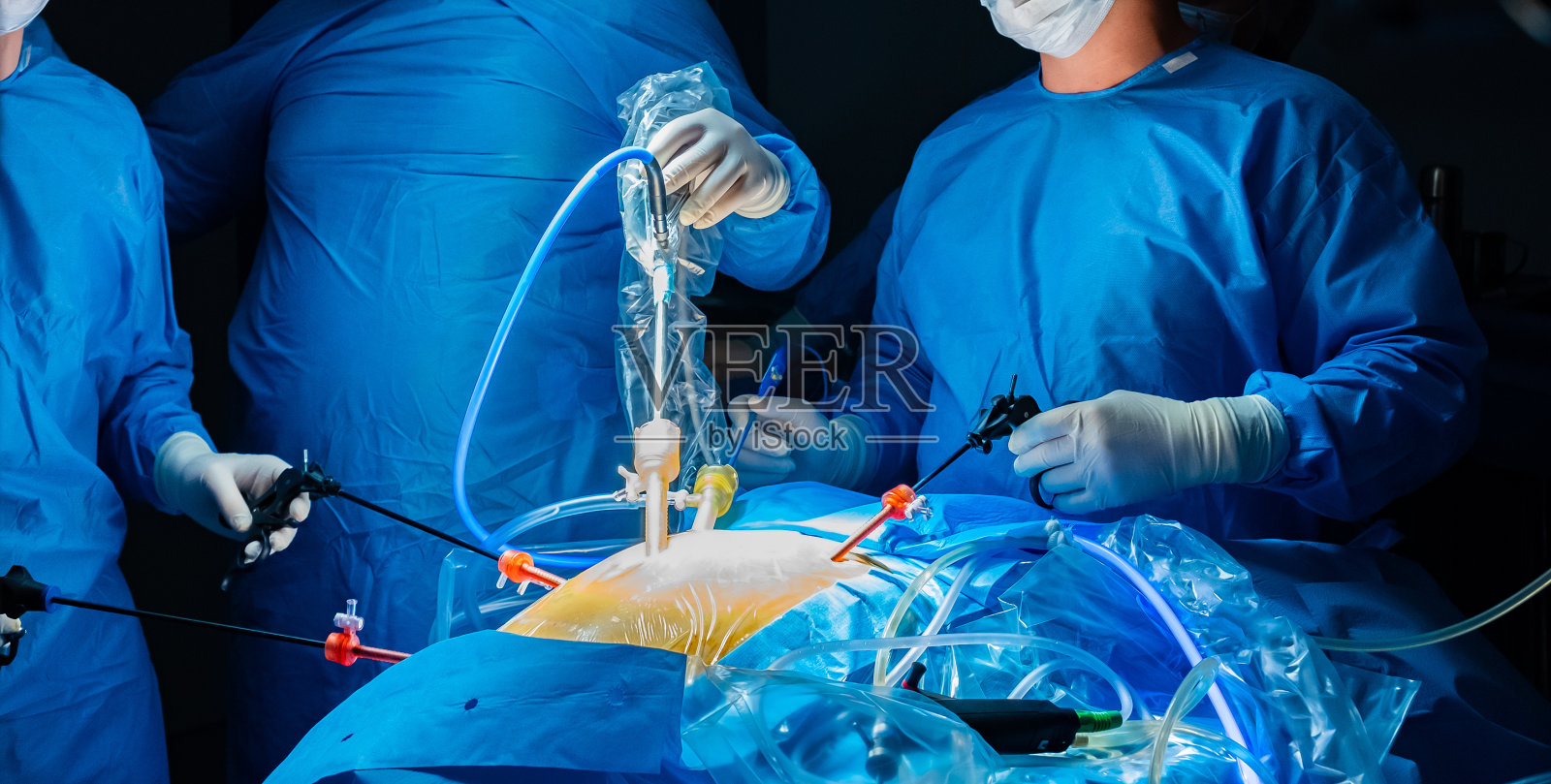 一组外科医生在手术灯的灯光下，在黑暗的手术室里工作照片摄影图片