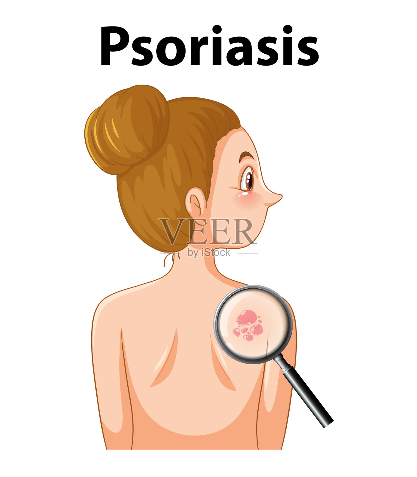 预兆与牛皮癣的漫画皮肤病插画图片素材