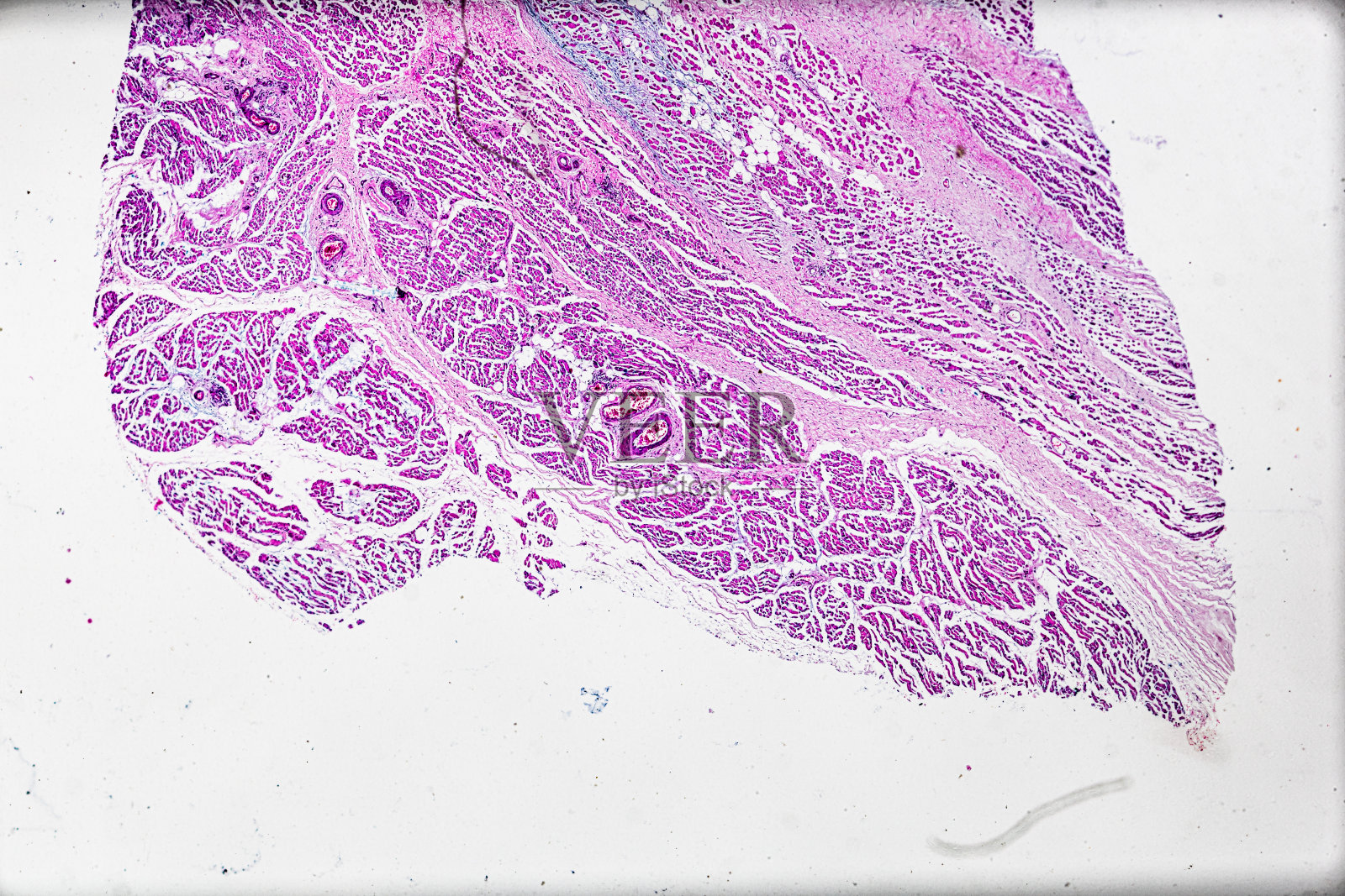 显微镜下人类骨骼肌萎缩病理标本照片摄影图片