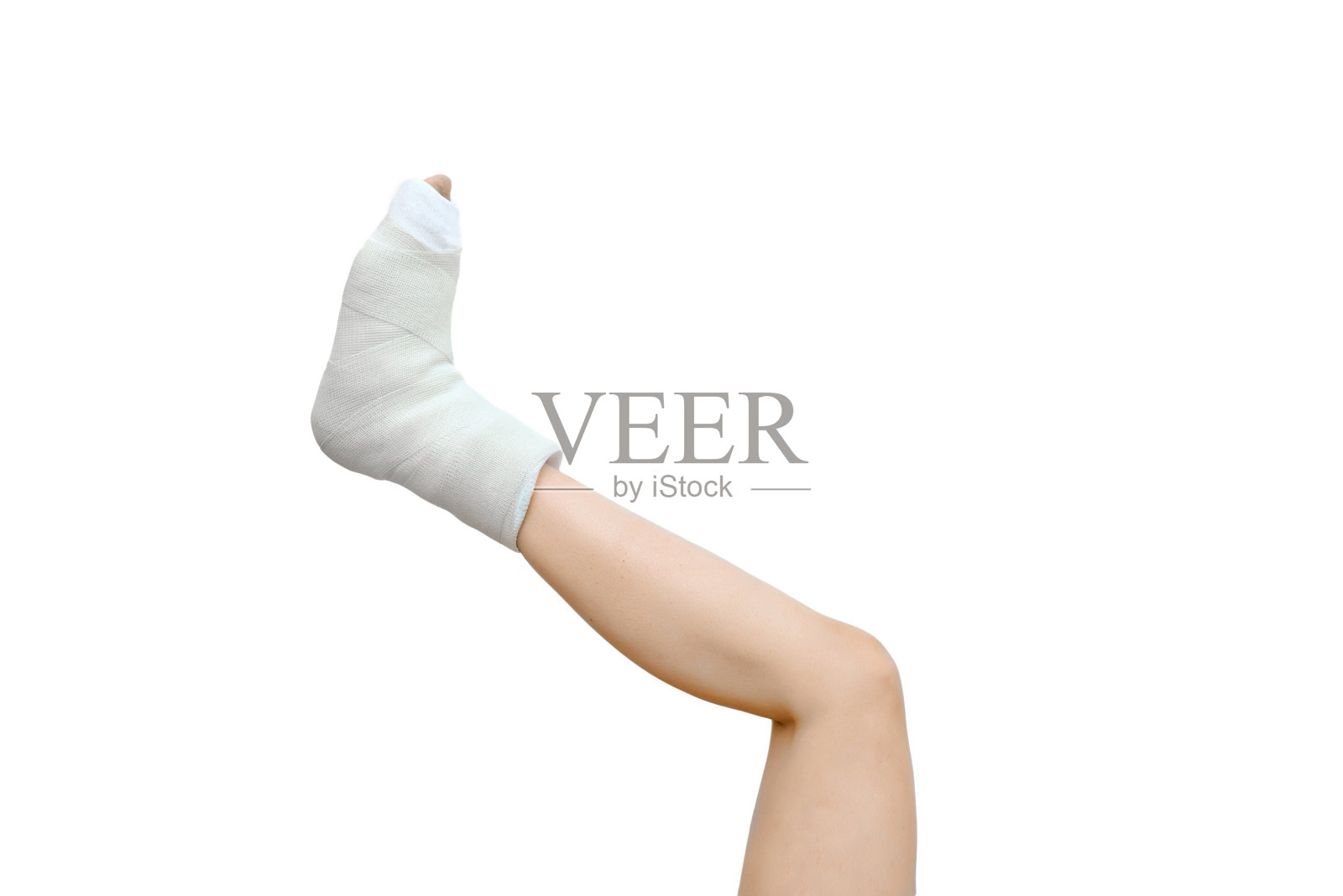 脚骨折，石膏打在白底上。脚踝上的白色膏药，保险诉讼。遭受痛苦。严重人身事故伤害照片摄影图片