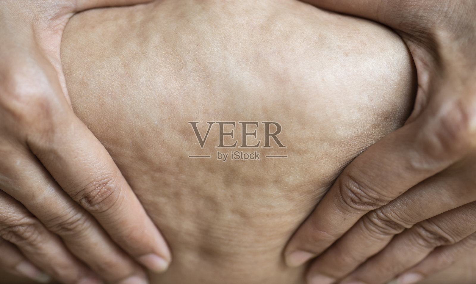 显示人体皮下脂肪表面的图像。照片摄影图片