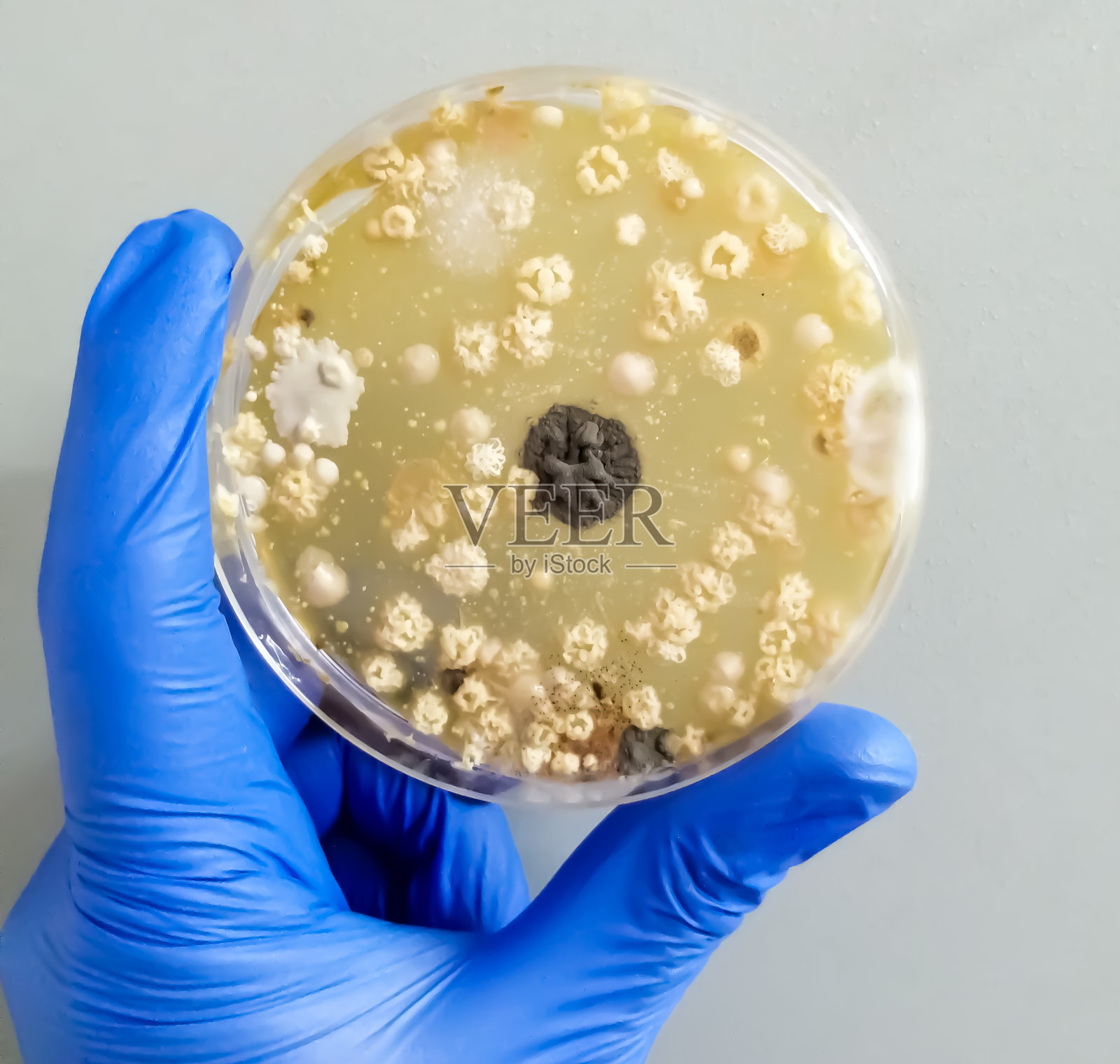 研究人员手持有盖培养皿，用麦芽提取物琼脂作为培养基分离培养酵母菌、霉菌真菌，在医学卫生实验室分析疾病照片摄影图片