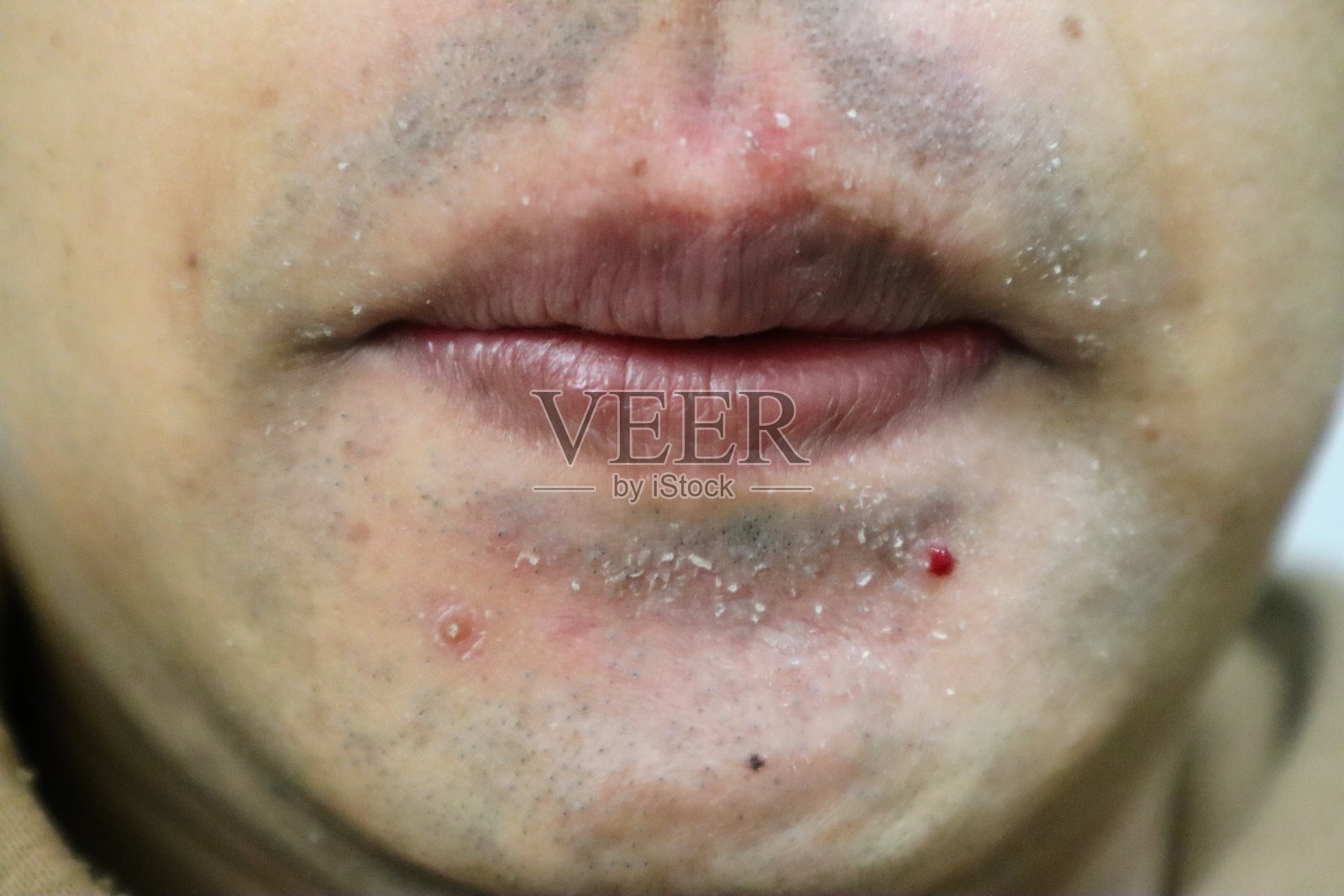 刮胡子后皮肤粗糙的人照片摄影图片