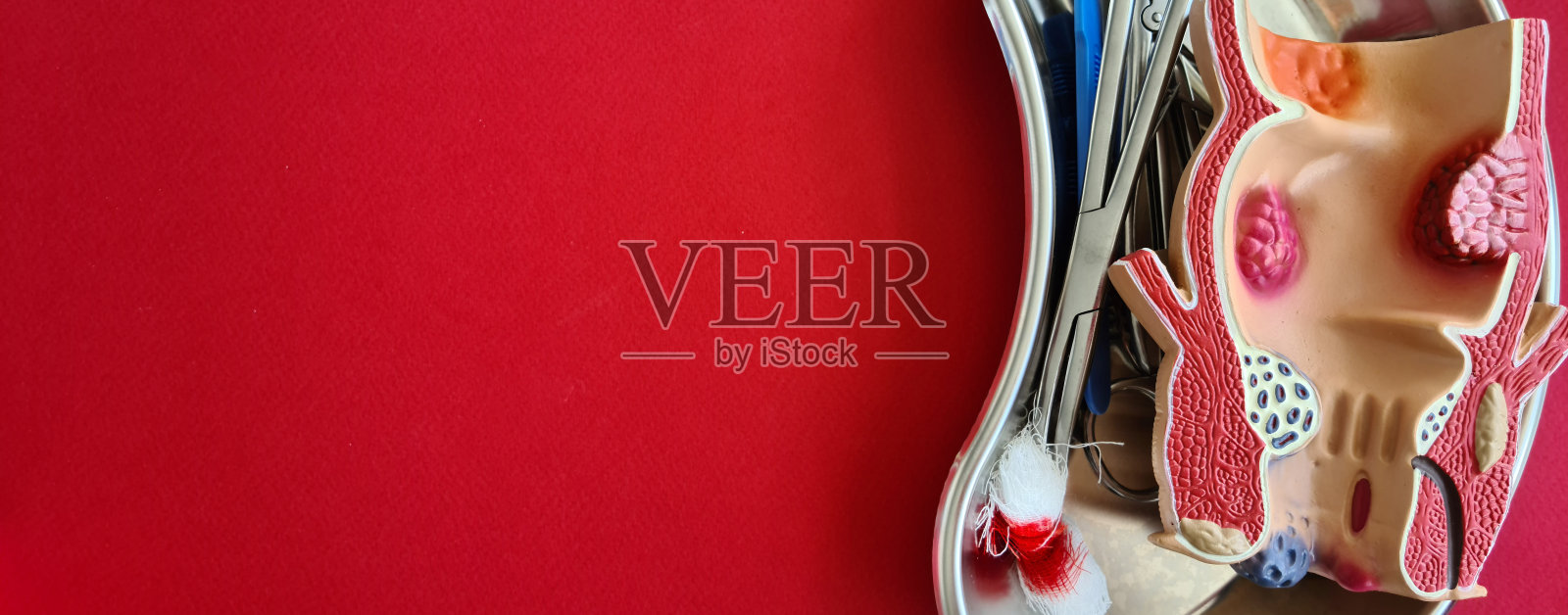 直肠科带痔直肠解剖模型及手术刀照片摄影图片