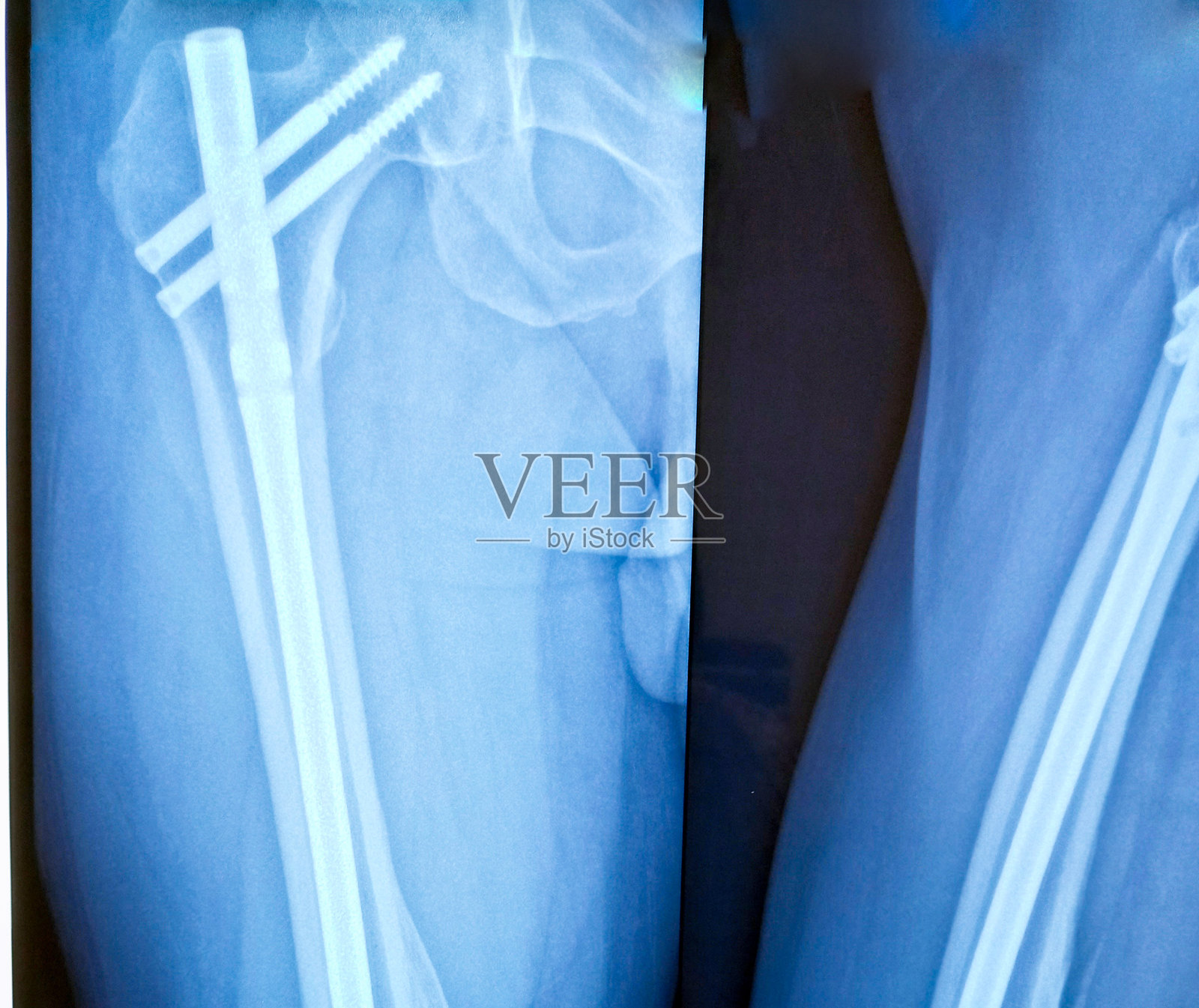 x射线图像。照片摄影图片